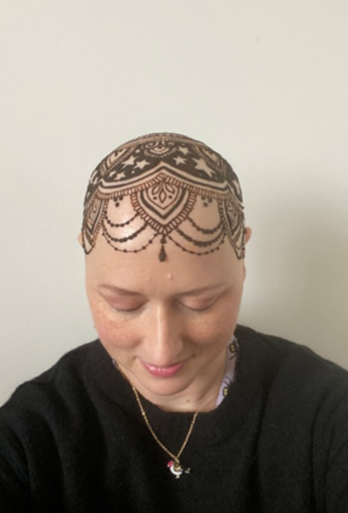 Henna crowns and hair loss